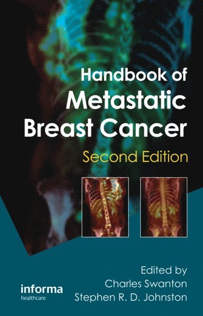 Stephen R. D. Johnston, Charles Swanton - Handbook of Metastatic Breast Cancer, E-bok. Tillgänglighet: Lägg i varukorg