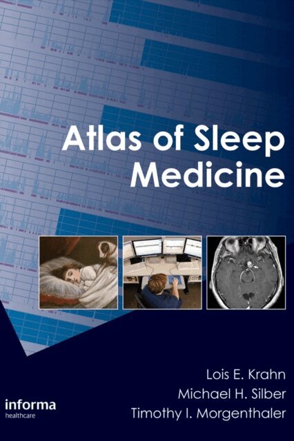 Timothy I. Morgenthaler, Michael H. Silber, Lois E. Krahn - Atlas of Sleep Medicine, E-bok. Tillgänglighet: Lägg i varukorg