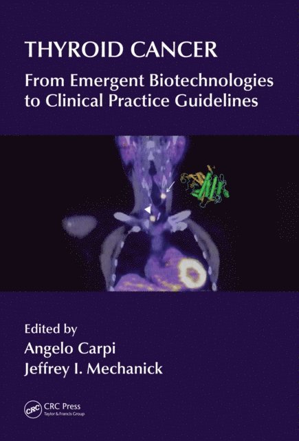 Jeffrey I Mechanick, Angelo Carpi - Thyroid Cancer, E-bok