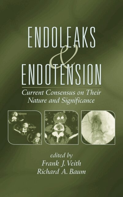 Richard Baum, Frank J. Veith - Endoleaks and Endotension, E-bok