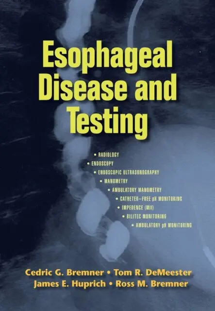 Ross M. Bremner, James E. Huprich, Tom R. DeMeester, Cedric G. Bremner - Esophageal Disease and Testing, E-bok. Tillgänglighet: Lägg i varukorg