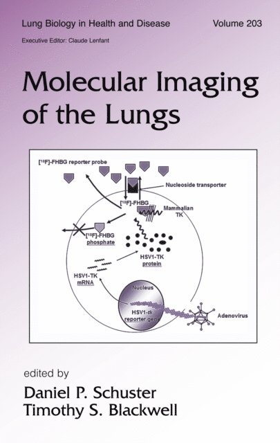 Timothy Blackwell, Daniel Schuster - Molecular Imaging of the Lungs, E-bok
