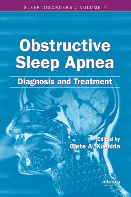 Clete A. Kushida - Obstructive Sleep Apnea, E-bok