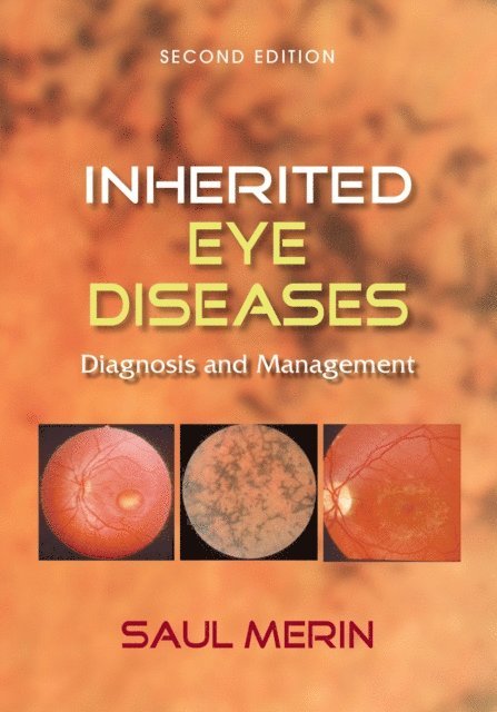 Saul Merin - Inherited Eye Diseases, E-bok. Tillgänglighet: Lägg i varukorg