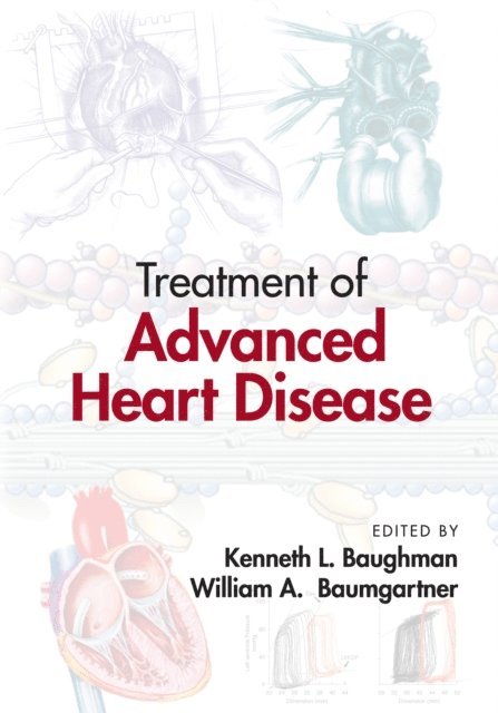 William A. Baumgartner, Kenneth L. Baughman - Treatment of Advanced Heart Disease, E-bok