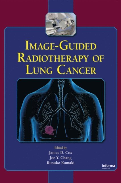 Ritsuko Komaki, Joe Y. Chang, James D. Cox - Image-Guided Radiotherapy of Lung Cancer, E-bok