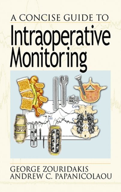 Andrew C. Papanicolaou, George Zouridakis - Concise Guide to Intraoperative Monitoring, E-bok