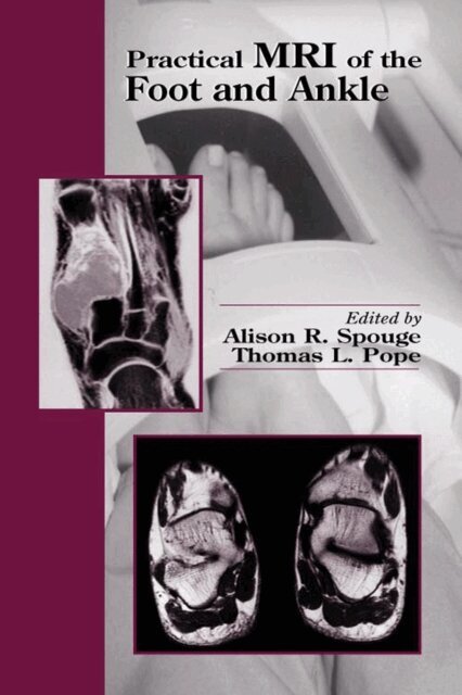 Thomas L Pope, Alison R. Spouge - Practical MRI of the Foot and Ankle, E-bok