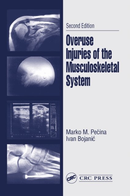 Ivan Bojanic, Marko M. Pecina - Overuse Injuries of the Musculoskeletal System, E-bok