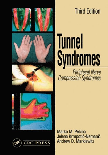 Jelena Krmpotic-Nemanic, Andrew D. Markiewitz, Marko M. Pecina - Tunnel Syndromes, E-bok