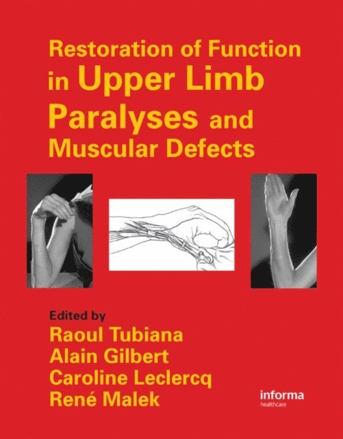 Rene Malek, Caroline Leclercq, Alain Gilbert, Raoul Tubiana - Restoration of Function in Upper Limb Paralyses and Muscular Defects, E-bok