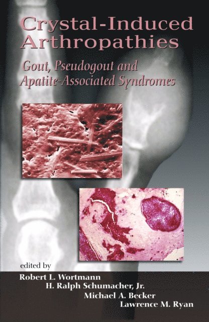 Lawrence M. Ryan, Michael A. Becker, H. Ralph Schumacher, Robert L. Wortmann - Crystal-Induced Arthropathies, E-bok
