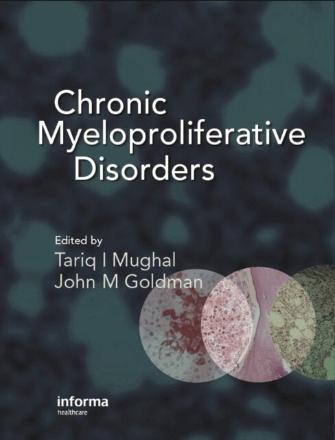 John M. Goldman, Tariq Mughal - Chronic Myeloproliferative Disorders, E-bok