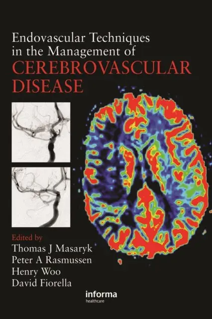 David Fiorella, Henry Woo, Peter Rasmussen, Thomas J. Masaryk - Endovascular Techniques in the Management of Cerebrovascular Disease, E-bok. Tillgänglighet: Lägg i varukorg