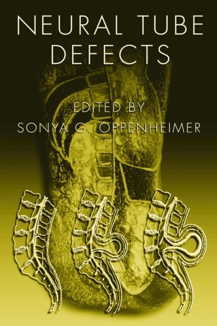 Sonya G. Oppenheimer - Neural Tube Defects, E-bok