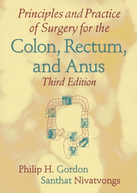 Santhat Nivatvongs, Philip H. Gordon - Principles and Practice of Surgery for the Colon, Rectum, and Anus, E-bok