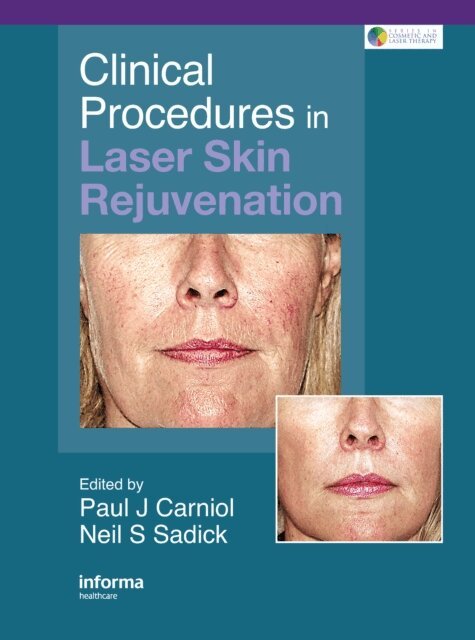 Neil S. Sadick, Paul Carniol - Clinical Procedures in Laser Skin Rejuvenation, E-bok
