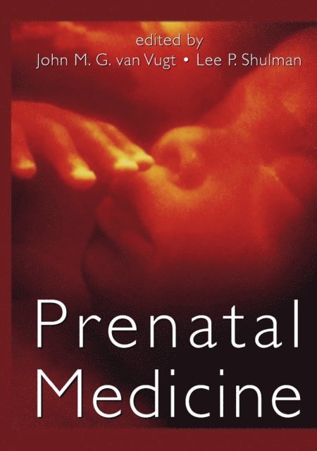 Lee P. Shulman, John M. G. van Vugt - Prenatal Medicine, E-bok. Tillgänglighet: Lägg i varukorg