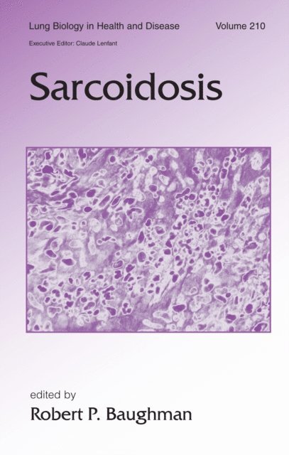 Robert Baughman - Sarcoidosis, E-bok