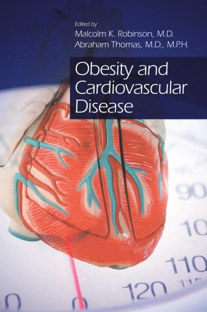 Abraham Thomas, Malcolm K Robinson - Obesity and Cardiovascular Disease, E-bok