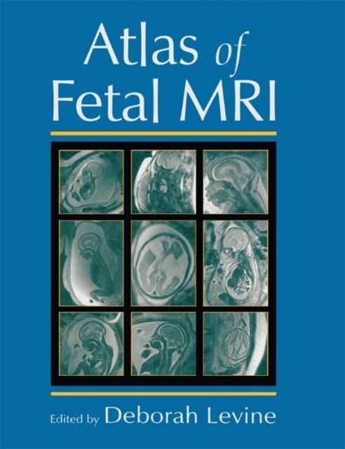 Deborah Levine - Atlas of Fetal MRI, E-bok