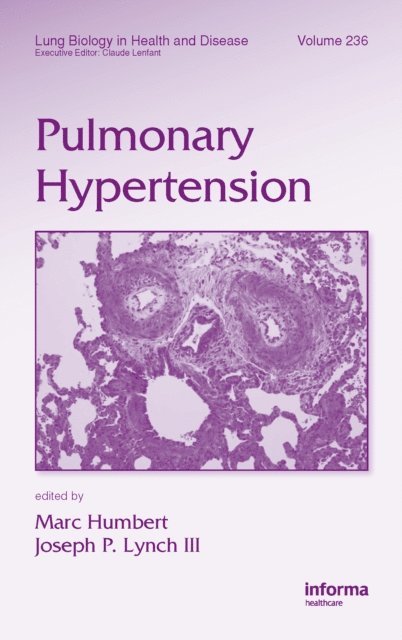 Joseph P. Lynch, Marc Humbert - Pulmonary Hypertension, E-bok