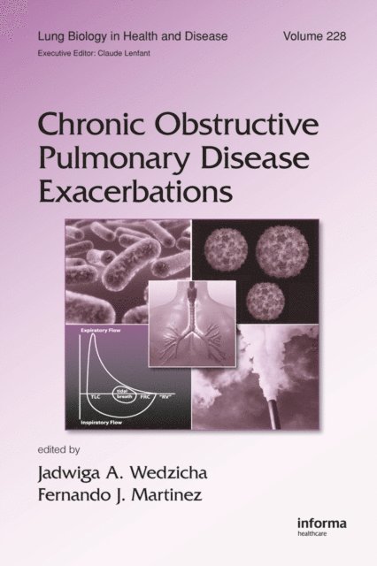 Fernando J. Martinez, Jadwiga A. Wedzicha - Chronic Obstructive Pulmonary Disease Exacerbations, E-bok