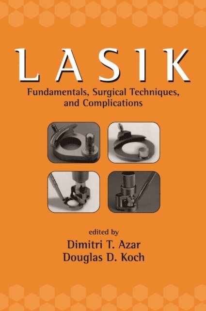 Douglas Koch, Dimitri T. Azar - LASIK (Laser in Situ Keratomileusis), E-bok