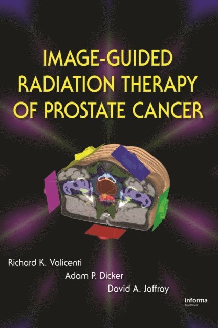 David A. Jaffray, Adam P. Dicker, Richard K. Valicenti - Image-Guided Radiation Therapy of Prostate Cancer, E-bok