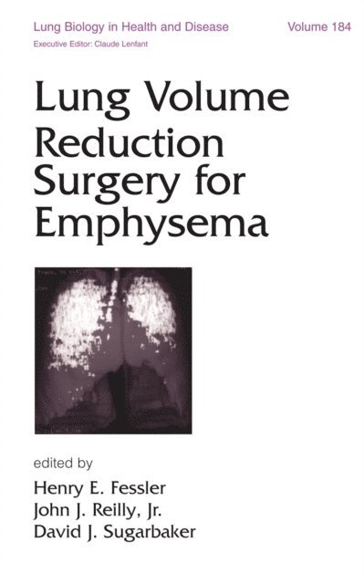 David Sugarbaker, Jr. John J. Reilly, Henry E. Fessler - Lung Volume Reduction Surgery for Emphysema, E-bok