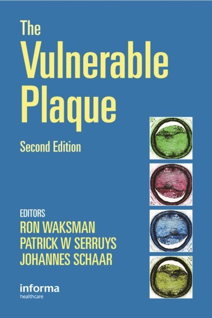 Johannes Schaar, Patrick W. Serruys, Ron Waksman - Handbook of the Vulnerable Plaque, E-bok