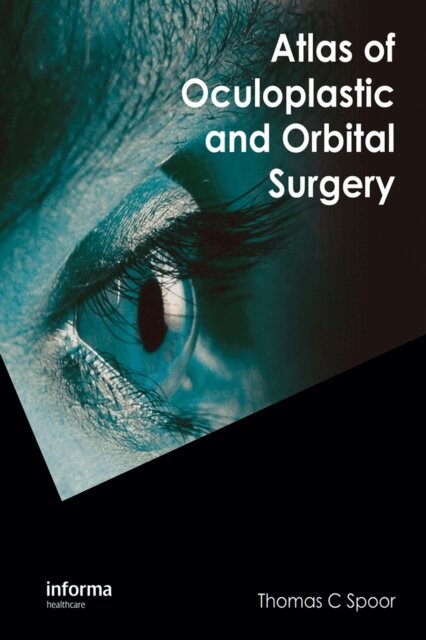 Thomas C. Spoor - Atlas of Oculoplastic and Orbital Surgery, E-bok