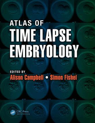 Alison Campbell, Simon Fishel - Atlas of Time Lapse Embryology, E-bok. Tillgänglighet: Lägg i varukorg