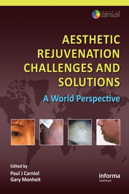 Gary D. Monheit, Paul J. Carniol - Aesthetic Rejuvenation Challenges and Solutions, E-bok