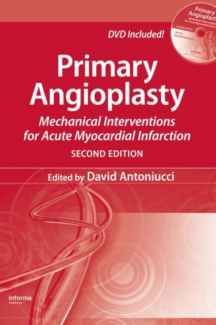 David Antoniucci - Primary Angioplasty, E-bok. Tillgänglighet: Lägg i varukorg