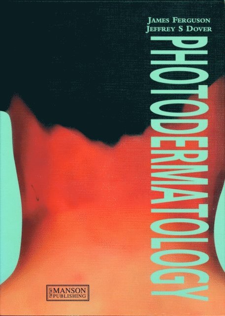 Jeffrey Dover, James Ferguson - Photodermatology, E-bok