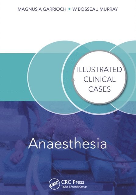 Bosseau Murray, Magnus Garrioch - Anaesthesia, E-bok