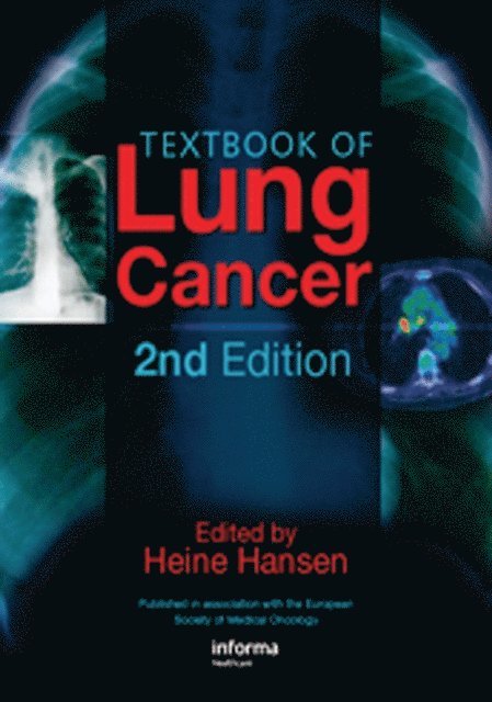 Heine Hansen - Textbook of Lung Cancer, E-bok