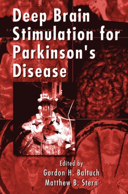 Matthew B. Stern, Gordon H. Baltuch - Deep Brain Stimulation for Parkinson's Disease, E-bok