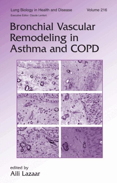 Aili Lazaar - Bronchial Vascular Remodeling in Asthma and COPD, E-bok. Tillgänglighet: Lägg i varukorg