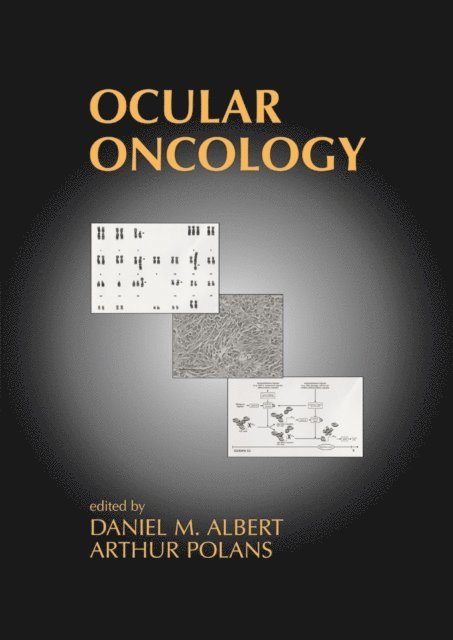 Arthur Polans, Daniel M. Albert - Ocular Oncology, E-bok