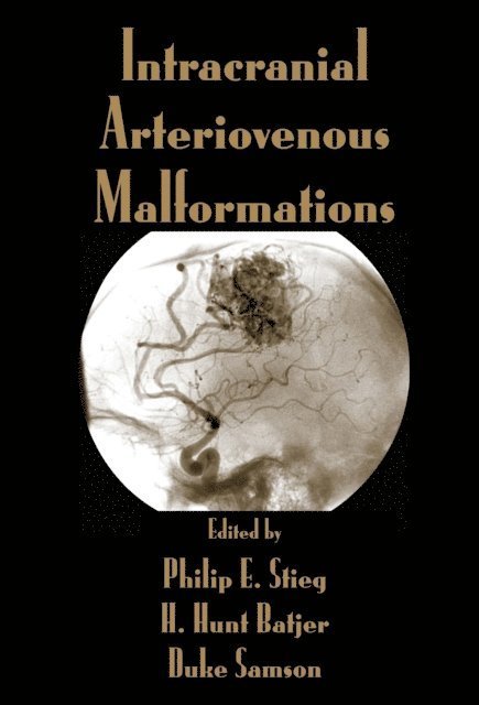 Duke Samson, H. Hunt Batjer, Philip E. Stieg - Intracranial Arteriovenous Malformations, E-bok