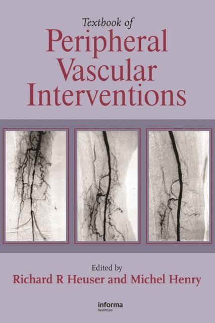 Michel Henry, Richard R. Heuser - Textbook of Peripheral Vascular Interventions, E-bok