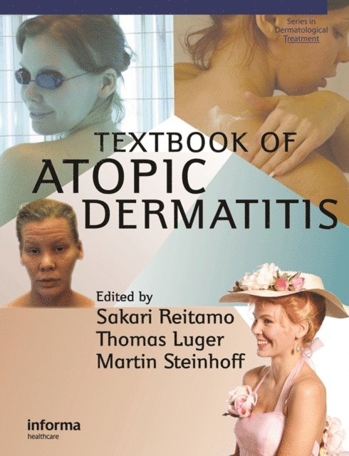Martin Steinhoff, Thomas A. Luger, Sakari Reitamo - Textbook of Atopic Dermatitis, E-bok