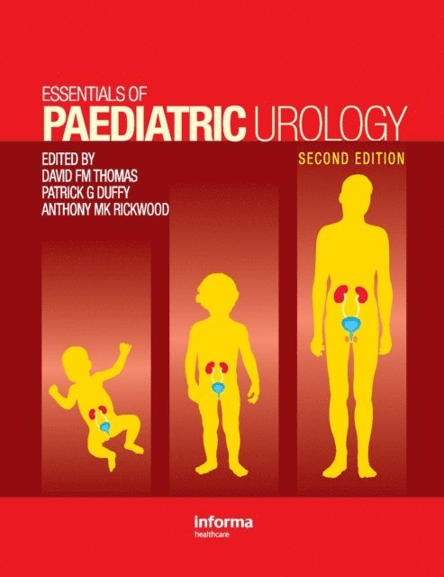 Anthony M. K. Rickwood, Patrick G. Duffy, David F. M. Thomas - Essentials of Paediatric Urology, E-bok