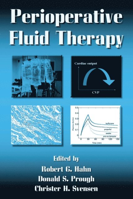 Christer H. Svensen, Donald S. Prough, Robert G. Hahn - Perioperative Fluid Therapy, E-bok