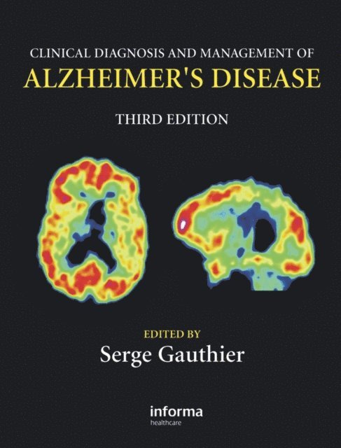 Serge Gauthier - Clinical Diagnosis and Management of Alzheimer's Disease, E-bok