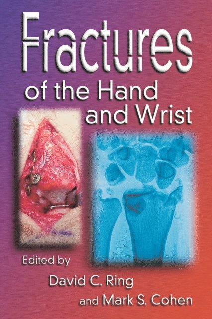 Mark Cohen, David C. Ring - Fractures of the Hand and Wrist, E-bok