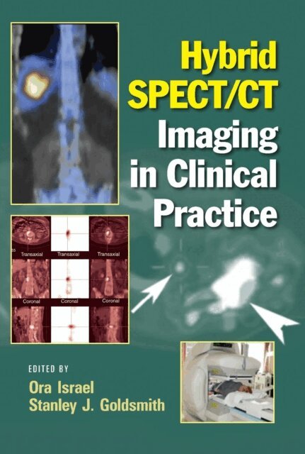 Stanley J. Goldsmith, Ora Israel - Hybrid SPECT/CT Imaging in Clinical Practice, E-bok
