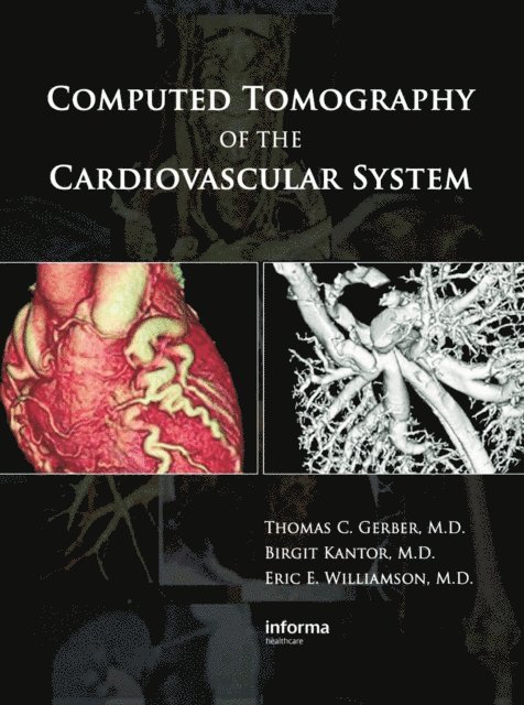 Eric E. Williamson, Birgit Kantor, Thomas C. Gerber - Computed Tomography of the Cardiovascular System, E-bok